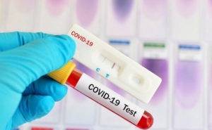 GÜRCİSTAN PCR TESTİ UYGULAMASINI SONLANDIRDI