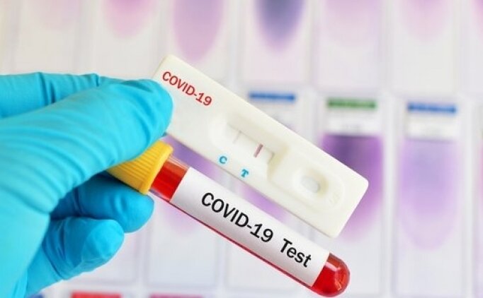 GÜRCİSTAN PCR TESTİ UYGULAMASINI SONLANDIRDI